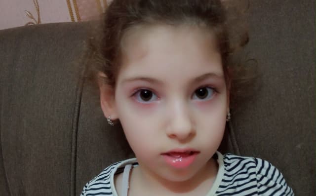 Evelina are nevoie de terapie ocupațională
